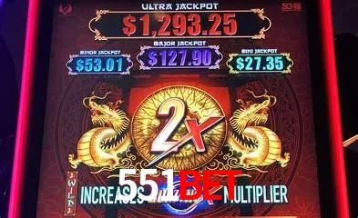 Live Casino 551bet